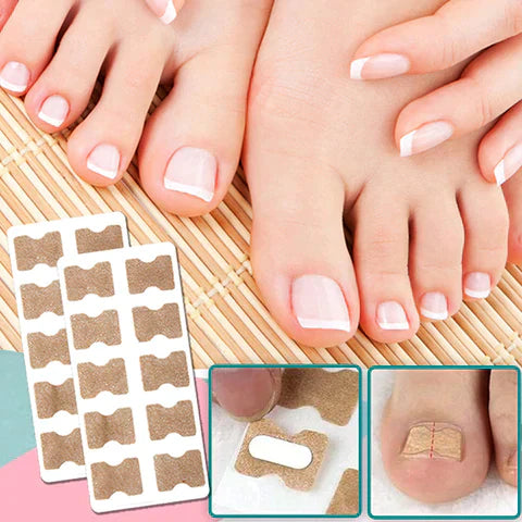 Nagelcorrector – Voor snel herstel en pijnvrije nagels