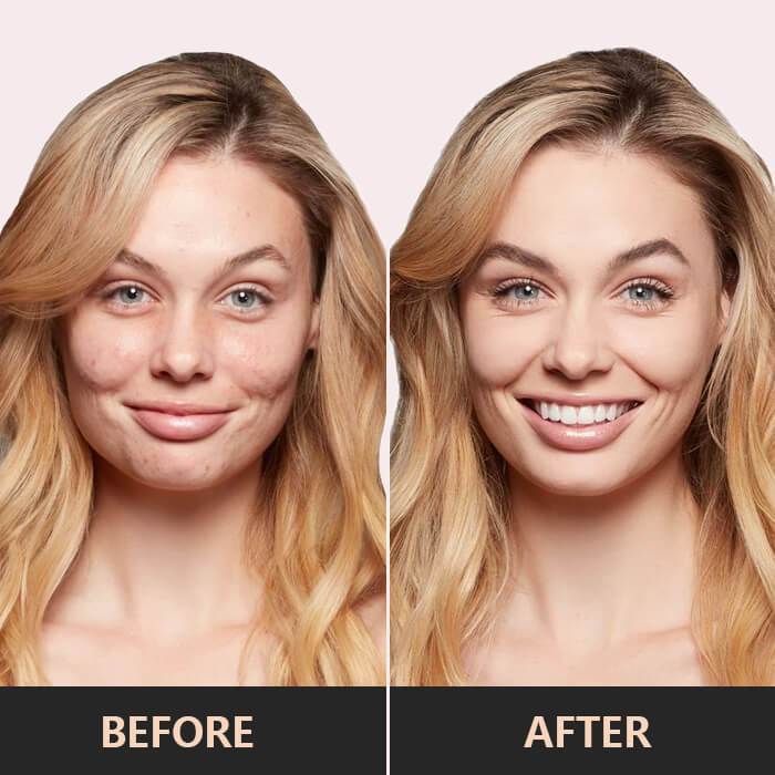 SkinBlend™ – Jeugdige Uitstraling